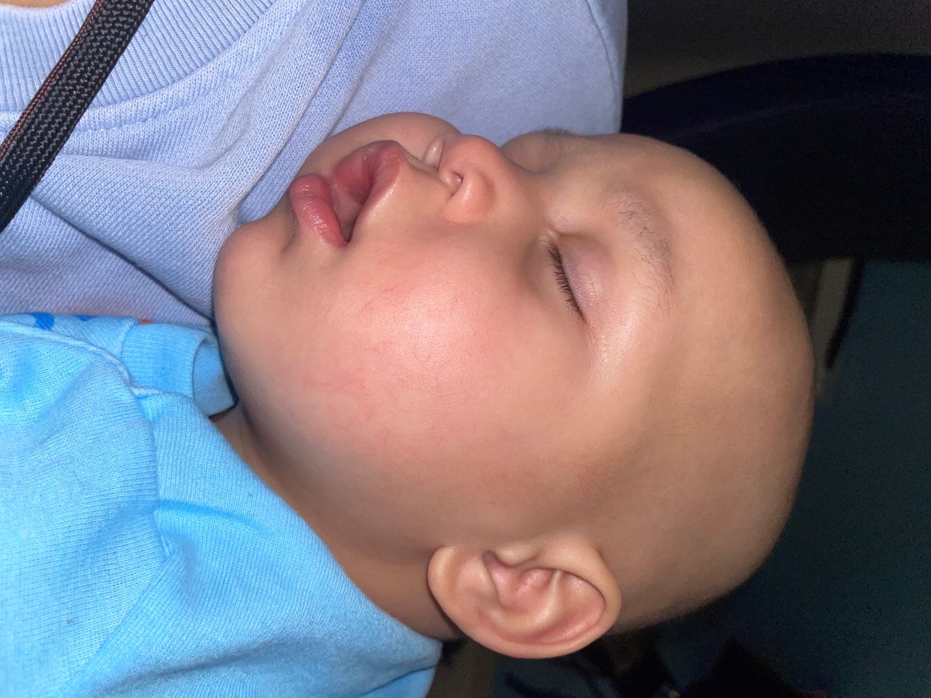 About the Braving NeuroBlastoma With Little Jimmie&nbsp; campaign on Bonfire 2