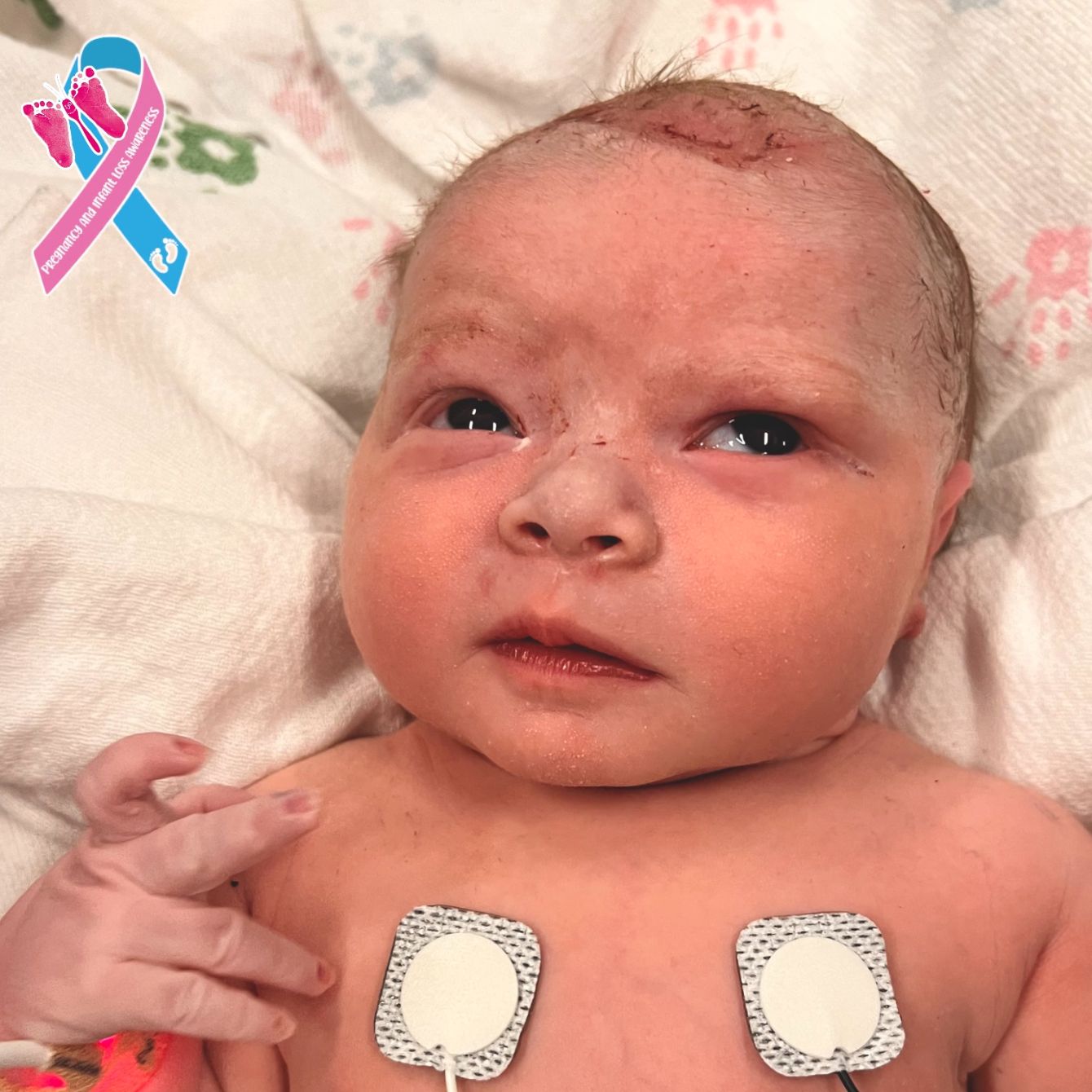 About the  campaign on Bonfire 2