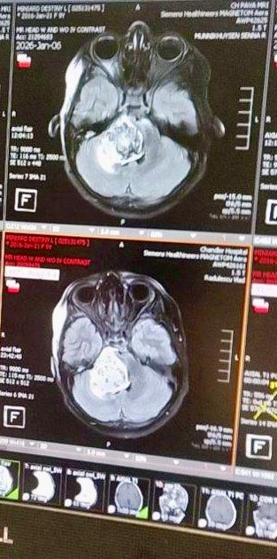 About the Fight DIPG with Destiny?? campaign on Bonfire 2