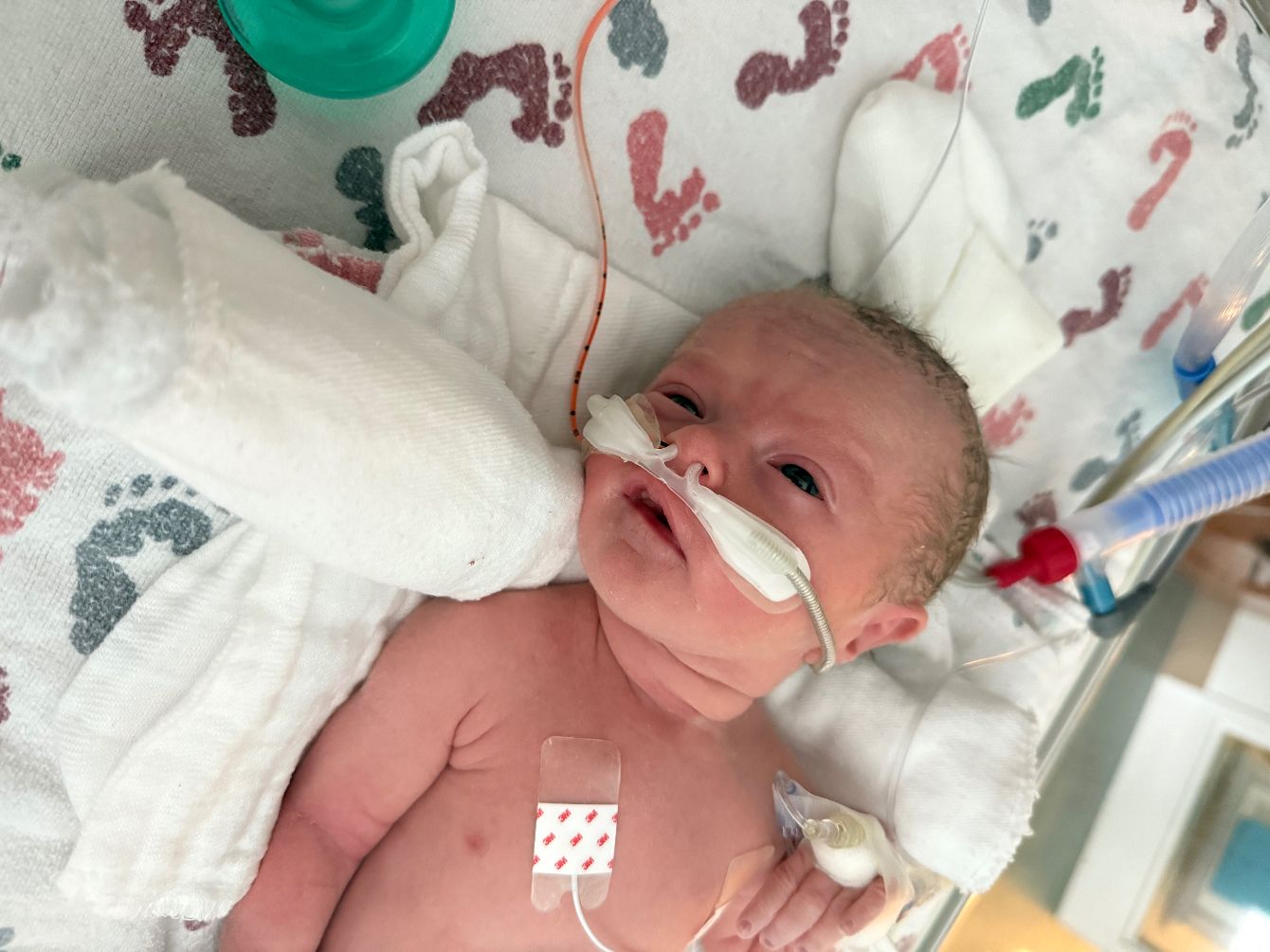 About the Impatient Since Birth campaign on Bonfire 2